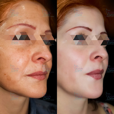 Slider image (8) Dr. Fernando Munar - Cirugia Plastica